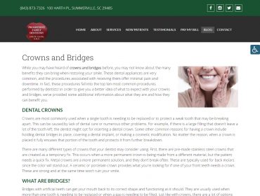 Crowns and Bridges